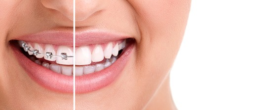 dental travel poland